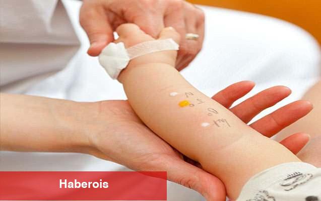 Çocuklarda alerji testi nasıl yapılır? Deri prick testi nedir?
