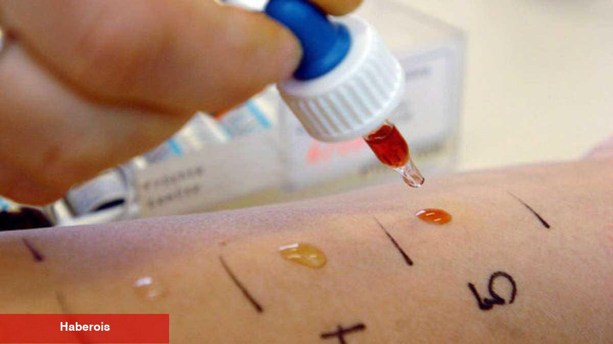 Çocuklarda alerji testi nasıl yapılır? Deri prick testi nedir?