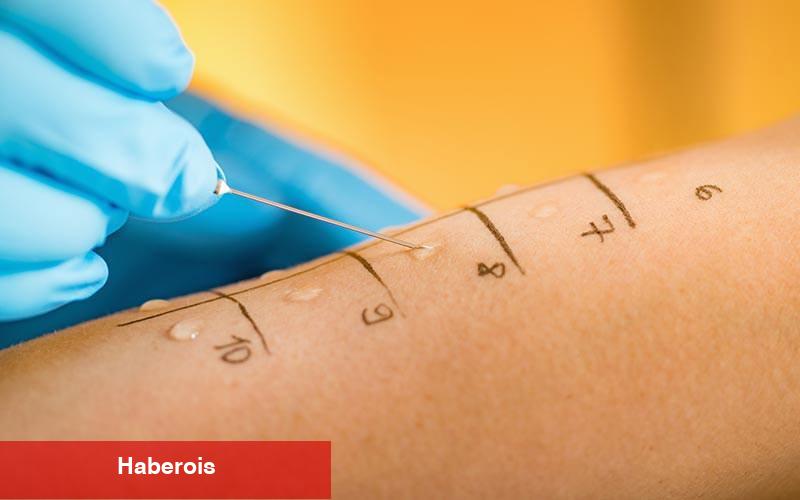 Çocuklarda alerji testi nasıl yapılır? Deri prick testi nedir?