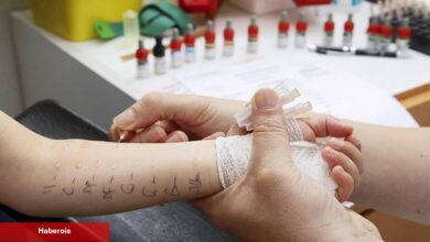 Çocuklarda alerji testi nasıl yapılır? Deri prick testi nedir?