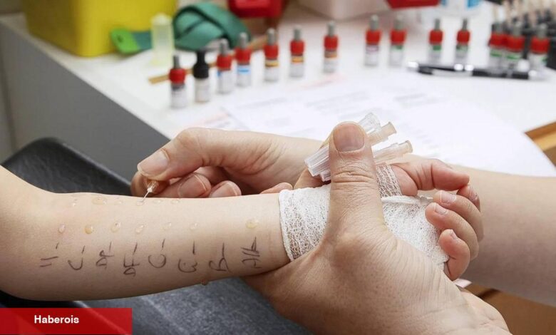 Çocuklarda alerji testi nasıl yapılır? Deri prick testi nedir? - Haberois Çocuklarda alerji testi nasıl yapılır? Deri prick testi nedir?