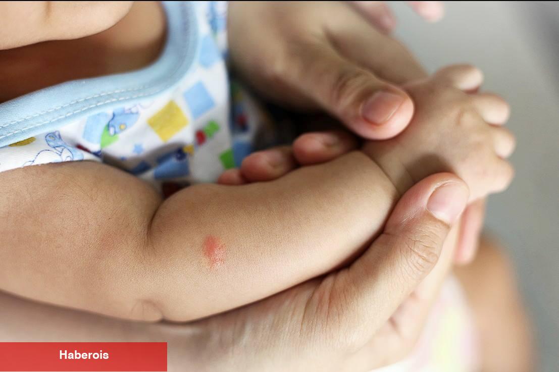 Bebek ve çocuklarda sivrisinek ısırıkları: Tedavisi ve tedbire yolları