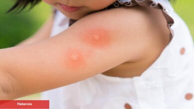 Bebek ve çocuklarda sivrisinek ısırıkları: Tedavisi ve tedbire yolları