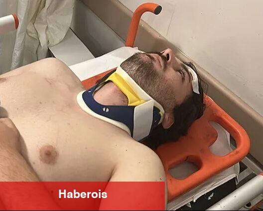 Oyuncu Mehmet Akif Akdeniz otobanda öldüresiye darp edildi! Dehşet dolu anlar sonrası açıklama