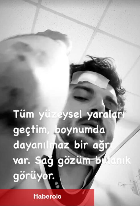Oyuncu Mehmet Akif Akdeniz otobanda öldüresiye darp edildi! Dehşet dolu anlar sonrası açıklama