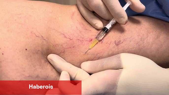 Varis deyip geçmeyin: Bacak sıhhatiniz alarm mı veriyor?
